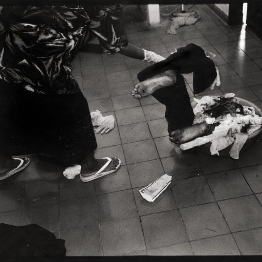 A cleaning lady at the Battambang hoospital throws amputated limbs into a trash basket following the double amputation of a CPAF soldier's legs. Cambodia
